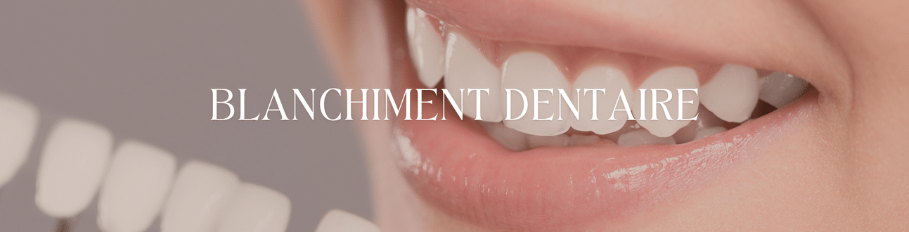 blanchiment dentaire charleroi